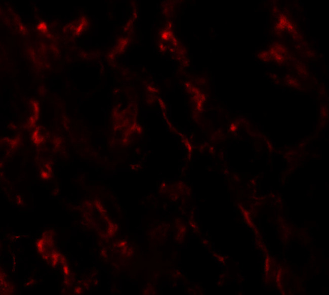 GHDC Antibody in Immunohistochemistry (IHC)