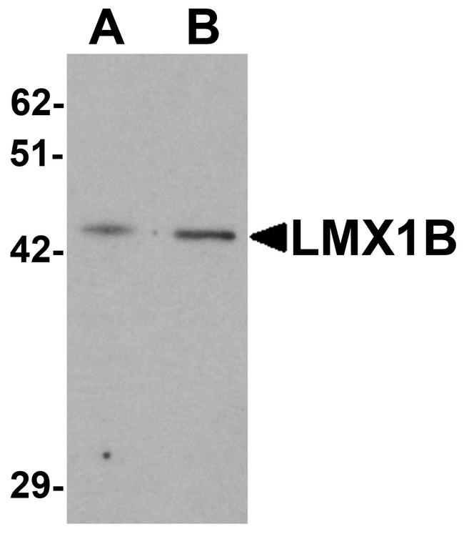 LMX1B Antibody in Western Blot (WB)