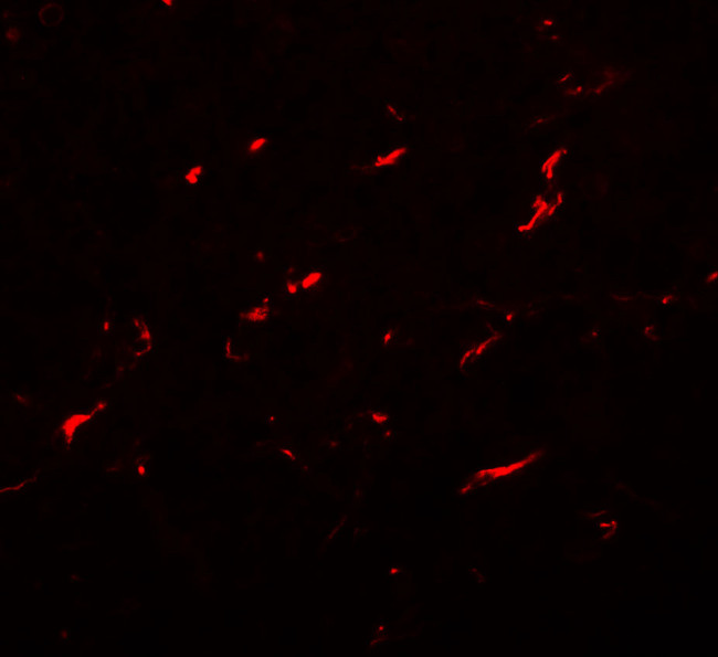 FMNL1 Antibody in Immunocytochemistry (ICC/IF)