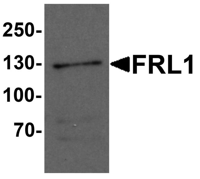 FMNL1 Antibody in Western Blot (WB)