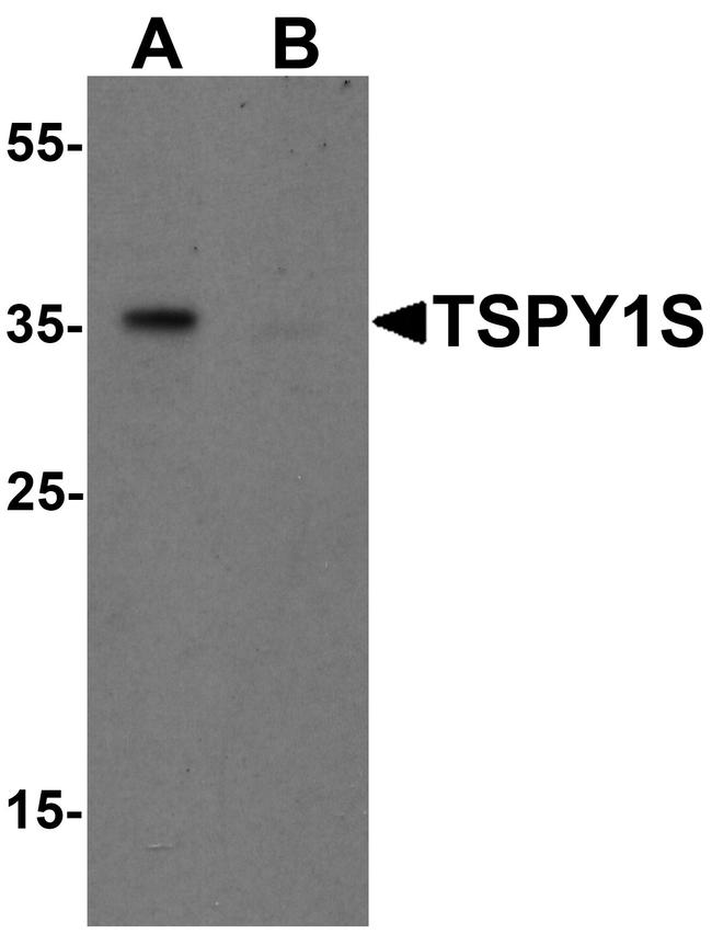 TSPY1L Antibody in Western Blot (WB)