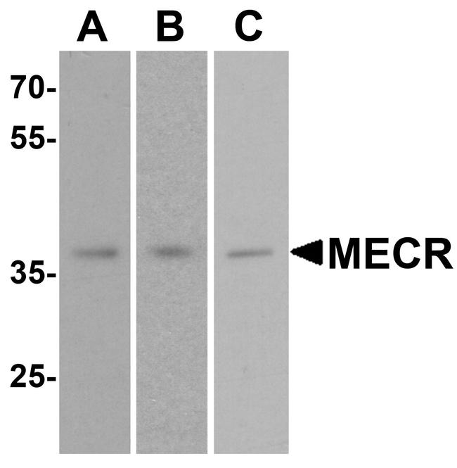 MECR Antibody in Western Blot (WB)