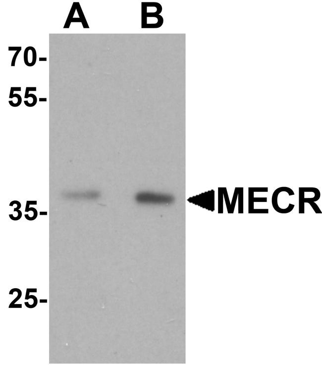 MECR Antibody in Western Blot (WB)