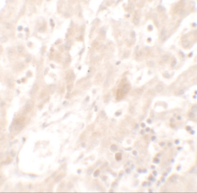 DHX36 Antibody in Immunohistochemistry (IHC)