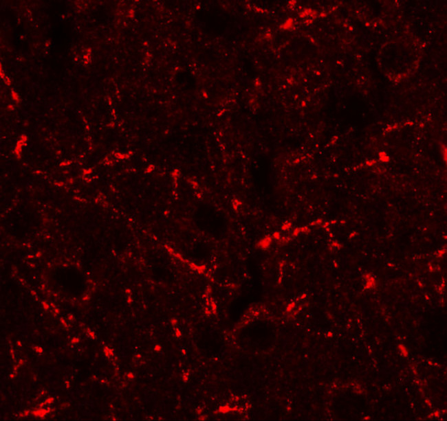 CCL4 Antibody in Immunohistochemistry (IHC)