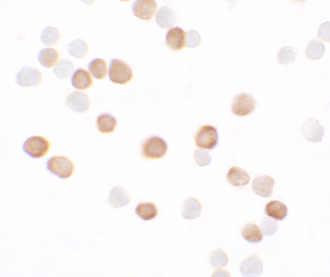 KREMEN2 Antibody in Immunocytochemistry (ICC/IF)