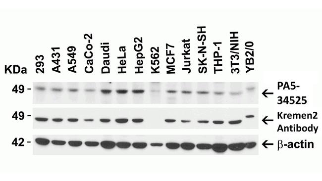 KREMEN2 Antibody in Western Blot (WB)