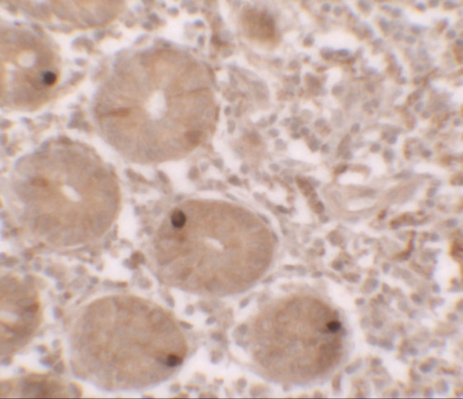 MTERFD2 Antibody in Immunohistochemistry (IHC)