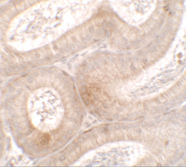 MTERFD3 Antibody in Immunohistochemistry (IHC)