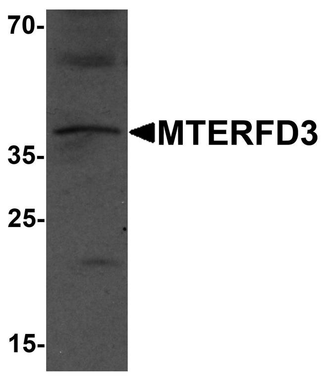 MTERFD3 Antibody in Western Blot (WB)