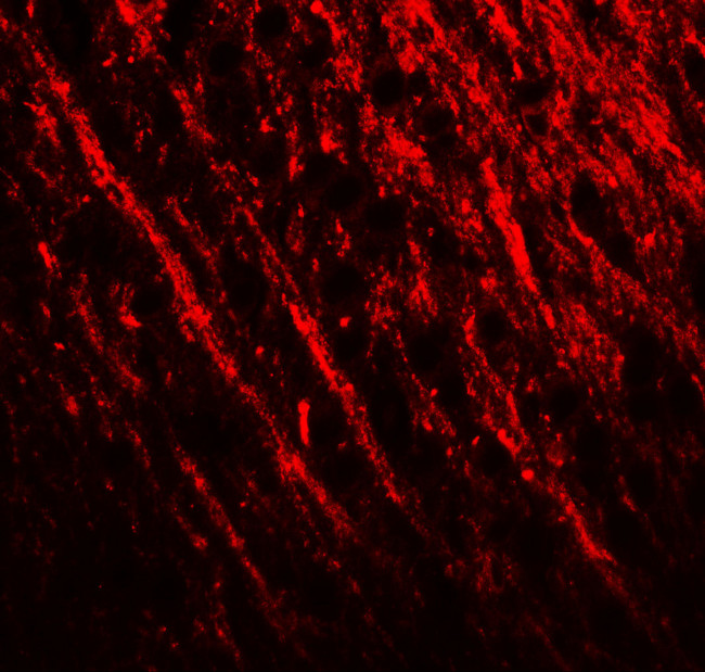 PRRT2 Antibody in Immunohistochemistry (IHC)