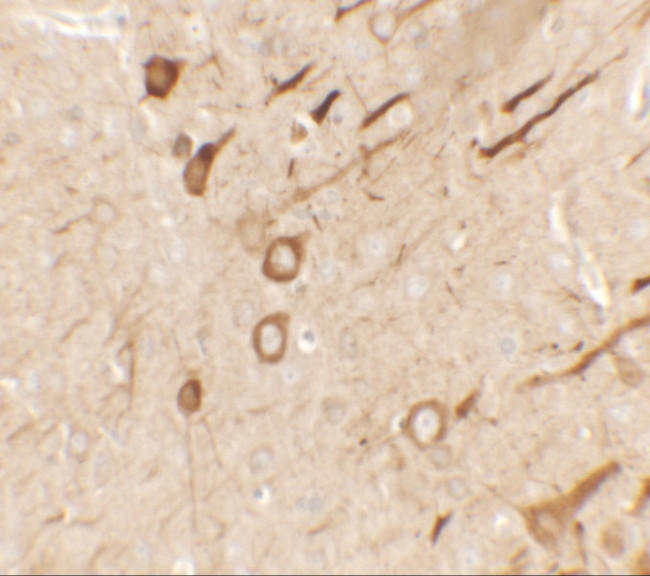 PRRT2 Antibody in Immunohistochemistry (IHC)