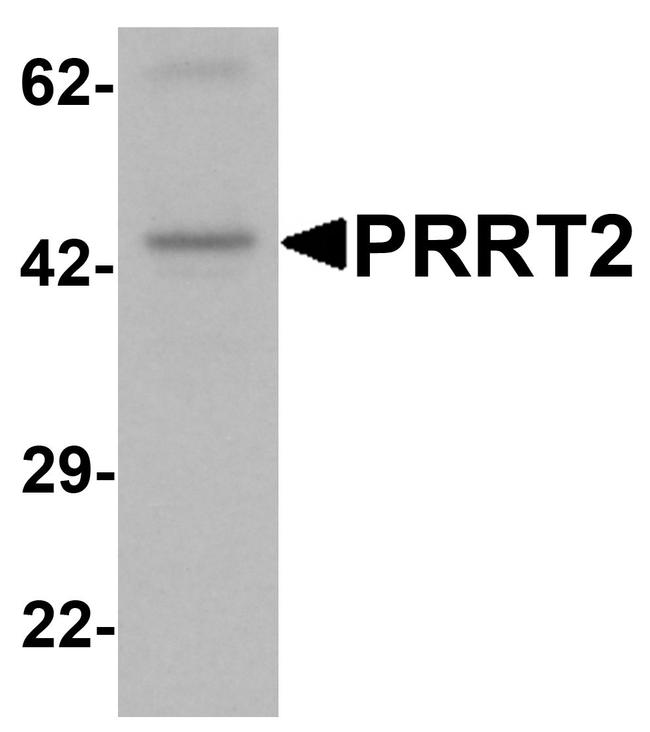 PRRT2 Antibody in Western Blot (WB)