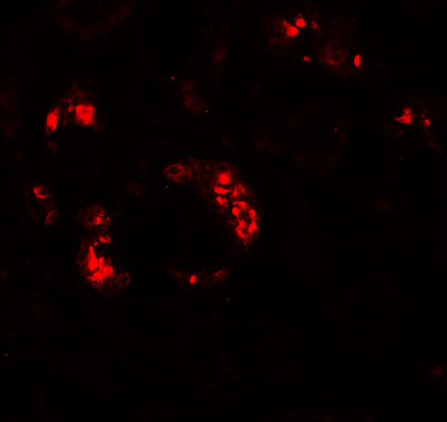 KANK2 Antibody in Immunohistochemistry (IHC)