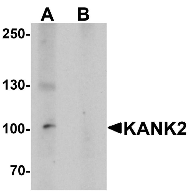 KANK2 Antibody in Western Blot (WB)