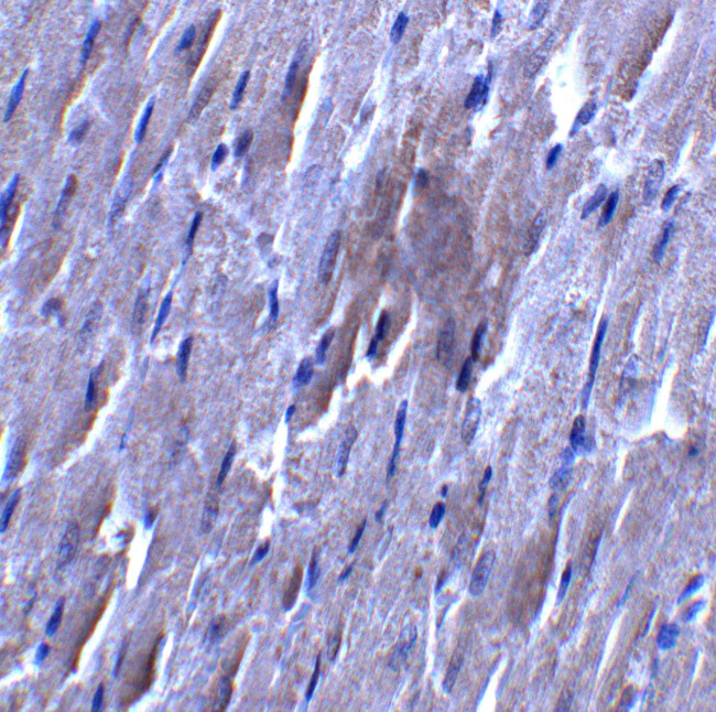 SLC27A6 Antibody in Immunocytochemistry (ICC/IF)