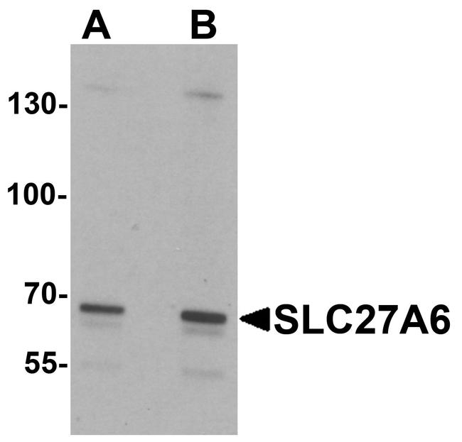 SLC27A6 Antibody in Western Blot (WB)