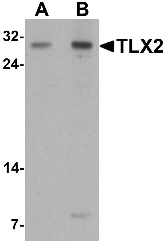 TLX2 Antibody in Western Blot (WB)