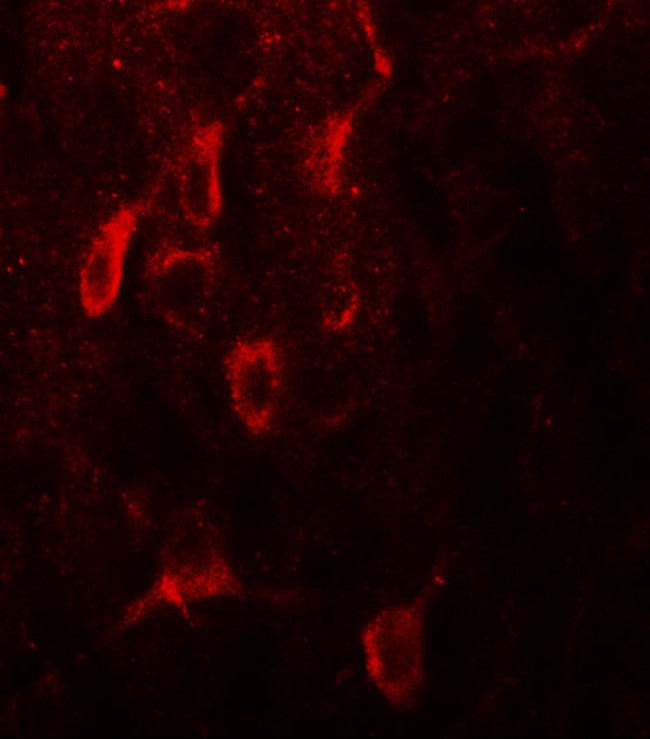 Estrogen Receptor alpha Antibody in Immunohistochemistry (IHC)