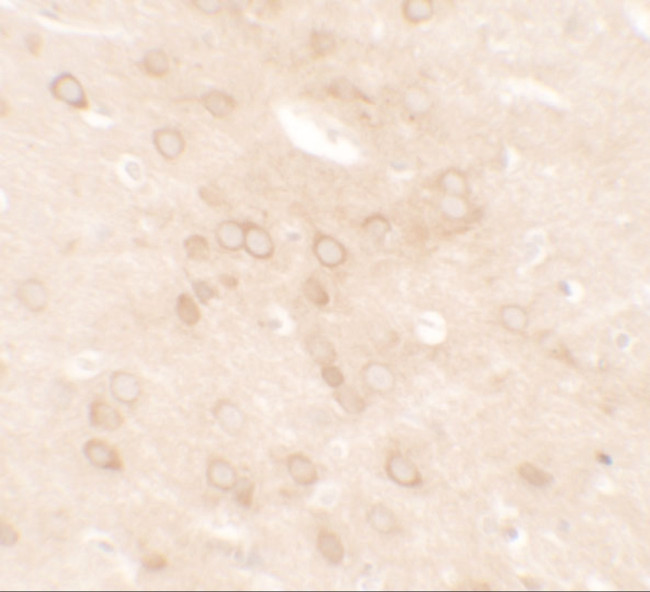 Estrogen Receptor alpha Antibody in Immunohistochemistry (IHC)