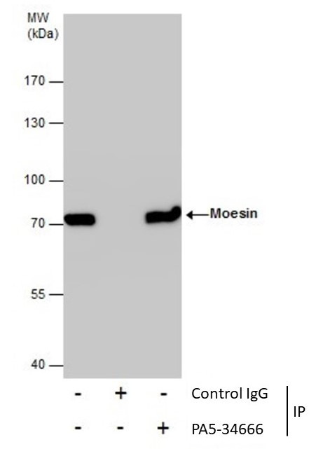 Moesin Antibody in Immunoprecipitation (IP)