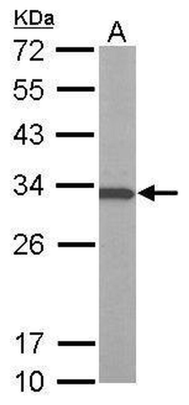 V-ATPase E1 Antibody in Western Blot (WB)