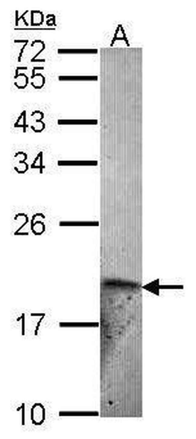 Endothelin 2 Antibody in Western Blot (WB)