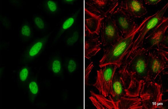 Cyclin A2 Antibody in Immunocytochemistry (ICC/IF)