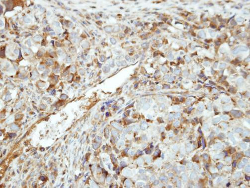 GK5 Antibody in Immunohistochemistry (Paraffin) (IHC (P))