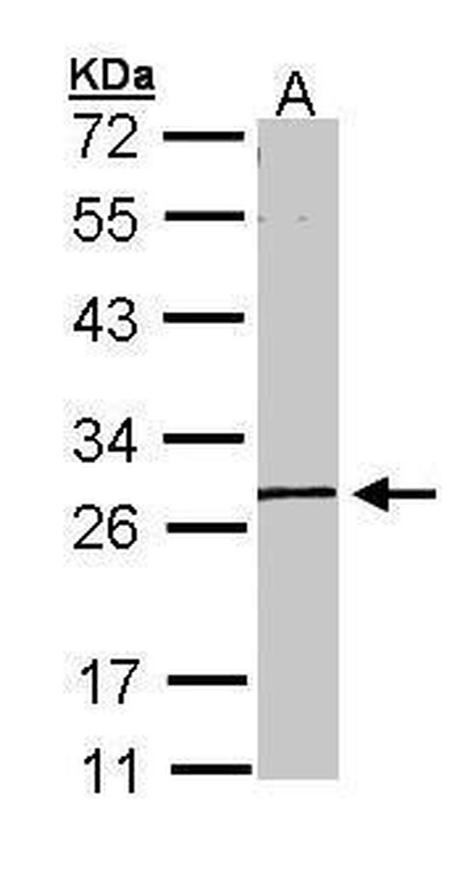 GK5 Antibody in Western Blot (WB)