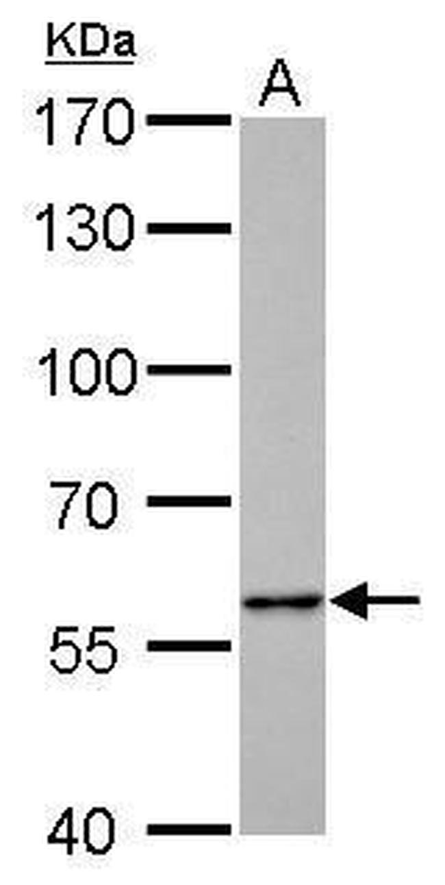 PKLR Antibody in Western Blot (WB)