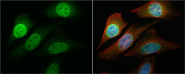 NFkB p65 Antibody in Immunocytochemistry (ICC/IF)