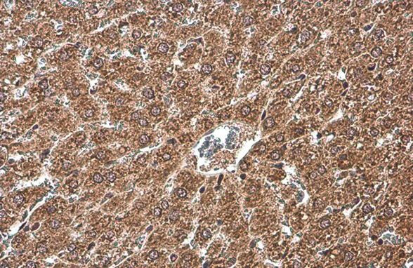 NFkB p65 Antibody in Immunohistochemistry (Paraffin) (IHC (P))