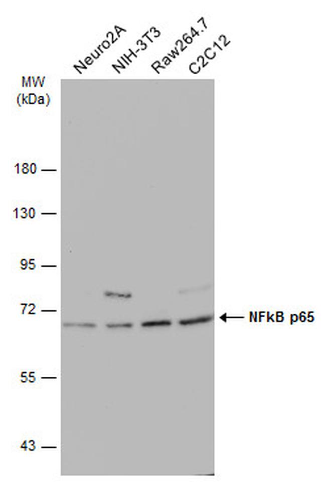 NFkB p65 Antibody in Western Blot (WB)