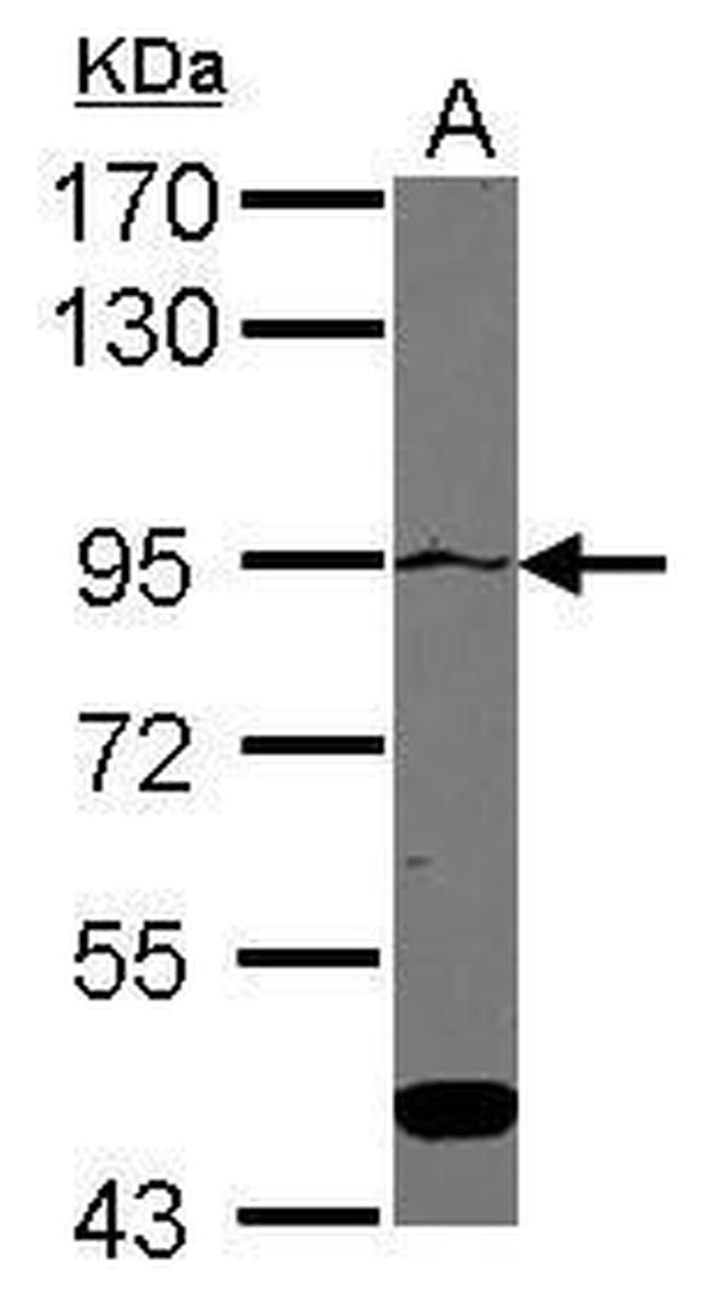 ATP2C1 Antibody in Western Blot (WB)