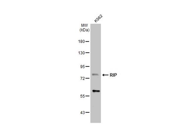 RIP1 Antibody in Western Blot (WB)