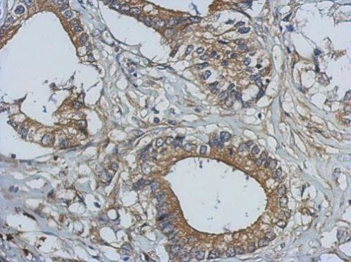 Bcl-10 Antibody in Immunohistochemistry (Paraffin) (IHC (P))