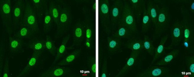 SMAD4 Antibody in Immunocytochemistry (ICC/IF)