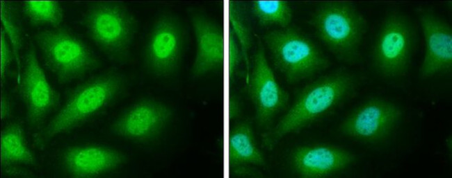 SMAD4 Antibody in Immunocytochemistry (ICC/IF)