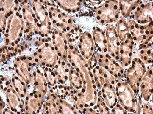 SMAD4 Antibody in Immunohistochemistry (Paraffin) (IHC (P))