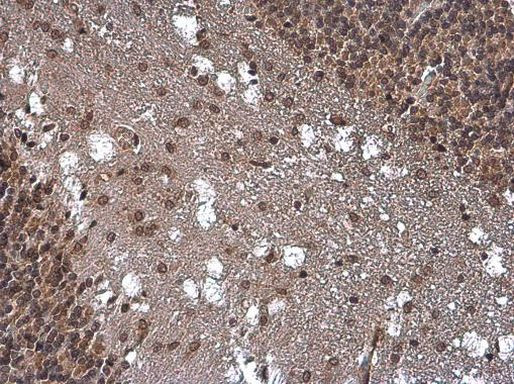 SMAD4 Antibody in Immunohistochemistry (Paraffin) (IHC (P))