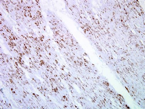 SMAD4 Antibody in Immunohistochemistry (Paraffin) (IHC (P))