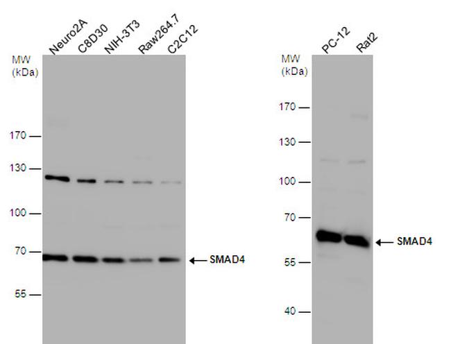 SMAD4 Antibody in Western Blot (WB)