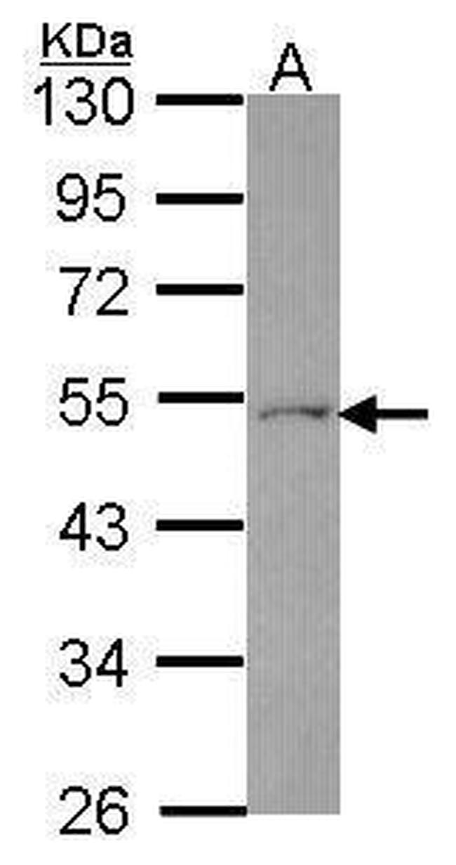 FDXR Antibody in Western Blot (WB)