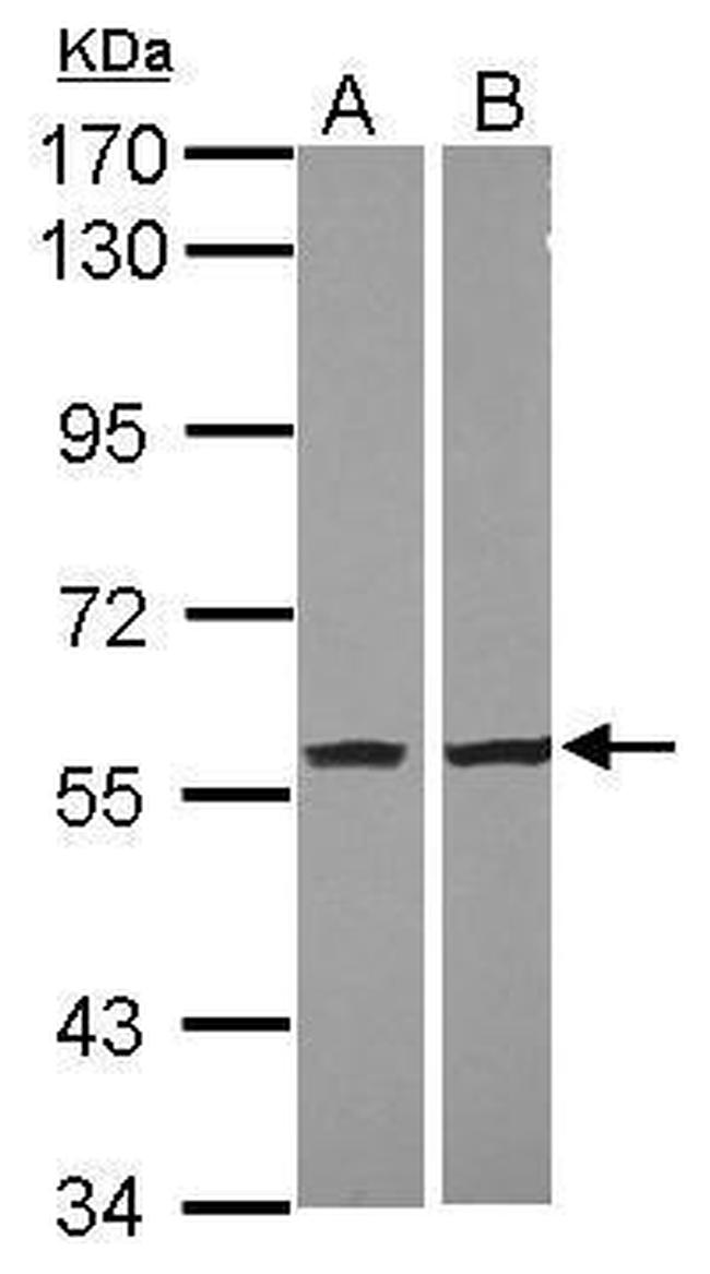 NAMPT Antibody in Western Blot (WB)