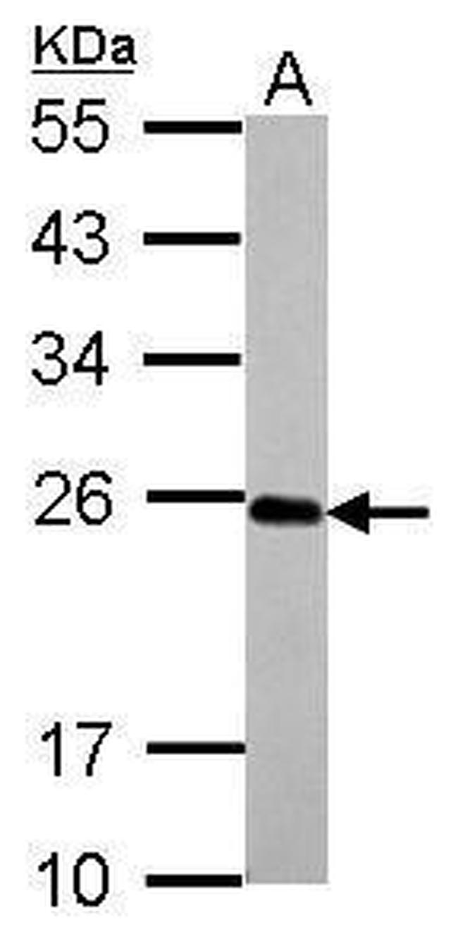 IL17C Antibody in Western Blot (WB)