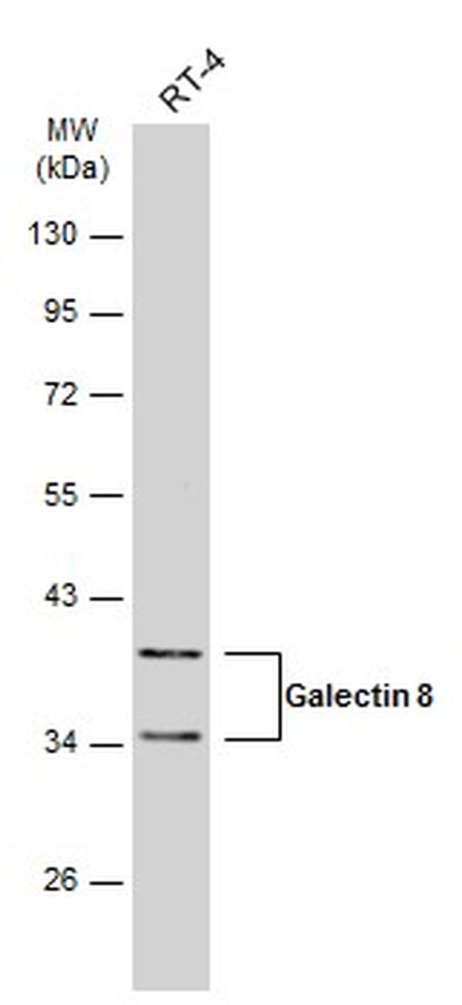 Galectin 8 Antibody in Western Blot (WB)