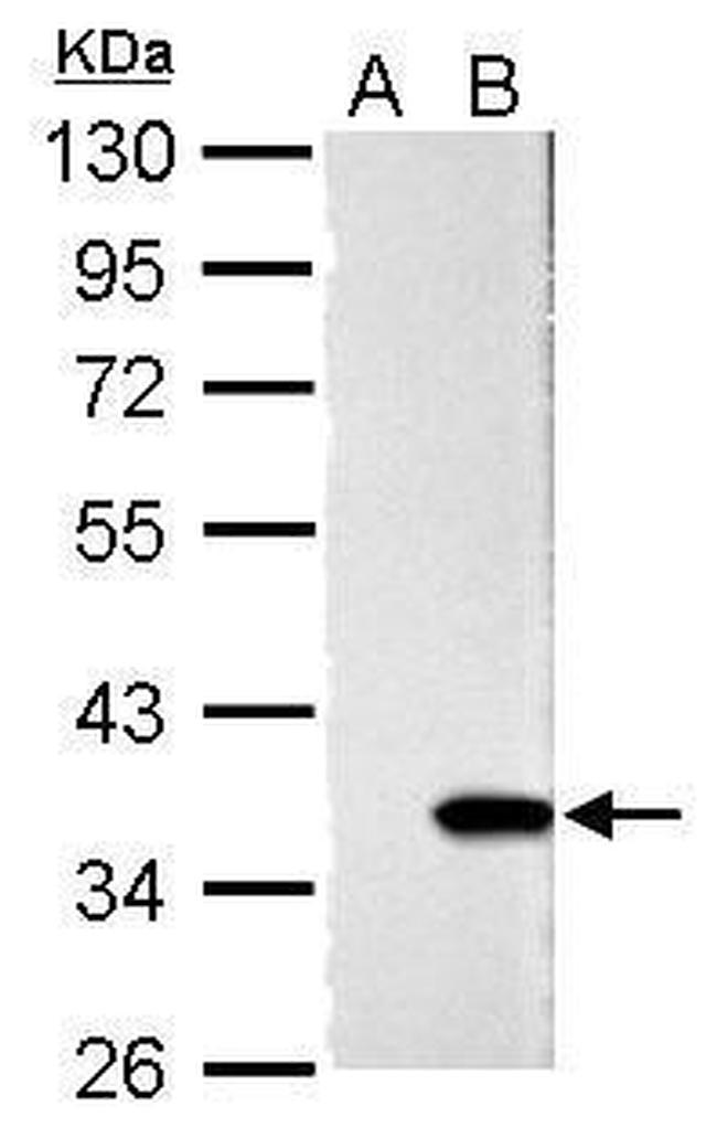 Galectin 4 Antibody in Western Blot (WB)