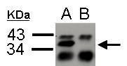 hnRNP A2B1 Antibody in Immunoprecipitation (IP)