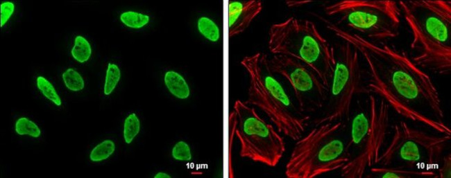 hnRNP A2B1 Antibody in Immunocytochemistry (ICC/IF)